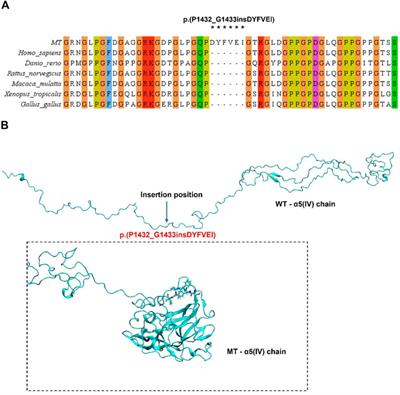 Frontiers | Molecular Dynamics And Minigene Assay Of New Splicing ...